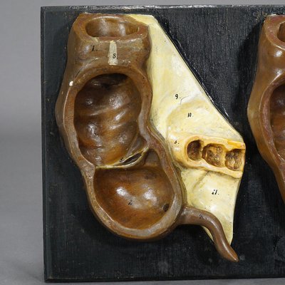 Antique Teaching Model Stages of the Appendix, 1900s-KJP-1149242