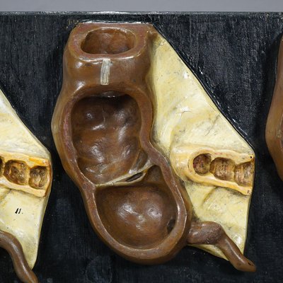 Antique Teaching Model Stages of the Appendix, 1900s-KJP-1149242