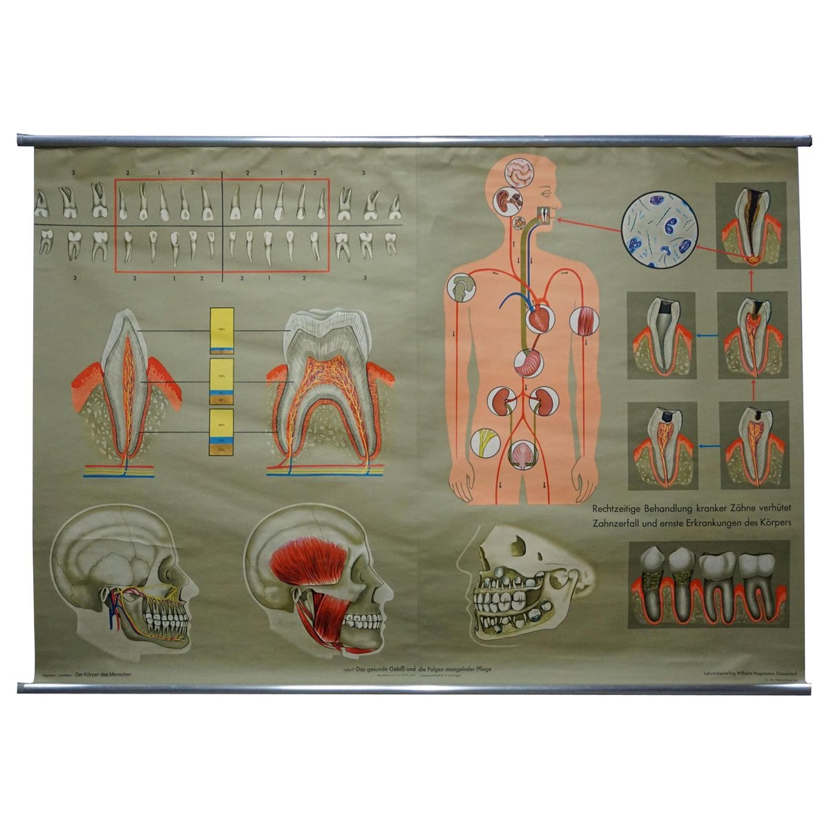 Healthy Teeth Jaw Head Human Body Poster Rollable Wall Chart Print