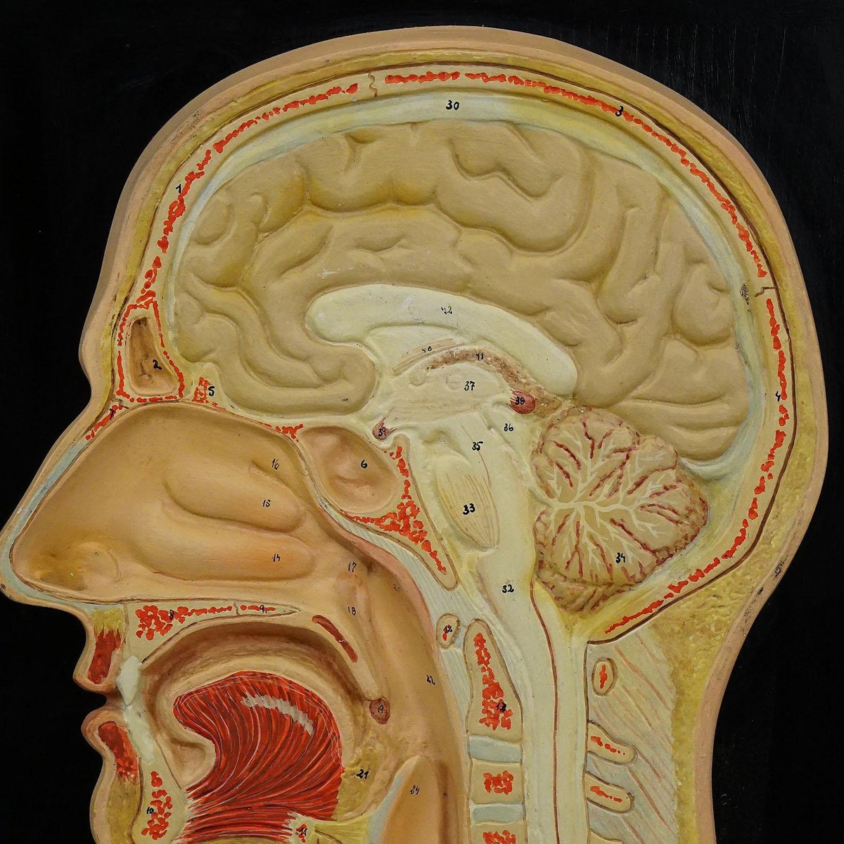 Median Incision of the Human Head Teaching Aid by Phywe