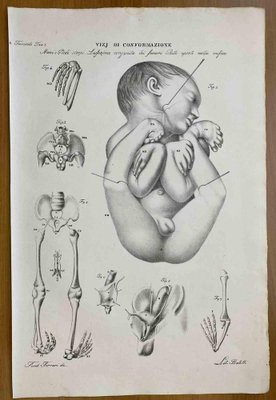 Ottavio Muzzi, Conformation Defects, Lithograph, 1843-ZCI-2030172