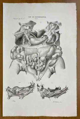 Ottavio Muzzi, Conformation Defects, Lithograph, 1843-ZCI-2030160