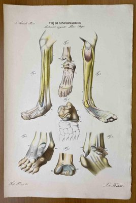 Ottavio Muzzi, Conformation Defects, Lithograph, 1843-ZCI-2030173