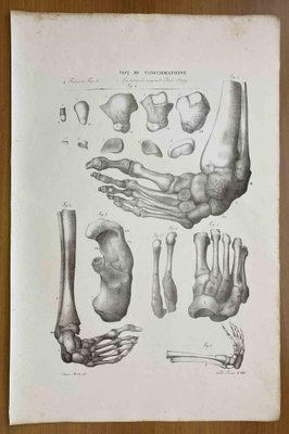 Ottavio Muzzi, Conformation Defects, Lithograph, 1843-ZCI-2030174