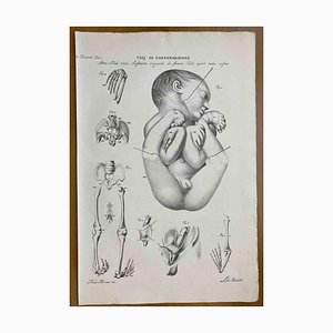 Ottavio Muzzi, Conformation Defects, Lithograph, 1843-ZCI-2030172