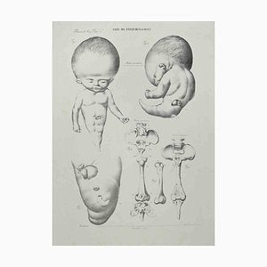 Ottavio Muzzi, Conformation Defects, Lithograph, 1843-ZCI-2029991