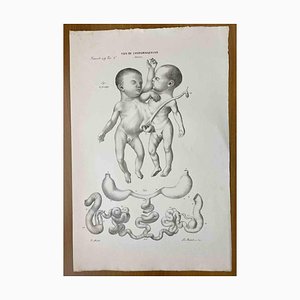 Ottavio Muzzi, Conformation Defects, Lithograph, 1843-ZCI-2030159