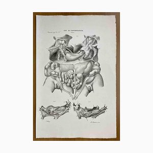 Ottavio Muzzi, Conformation Defects, Lithograph, 1843-ZCI-2030160