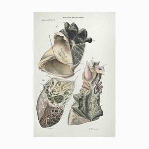 Ottavio Muzzi, Diseases of the Brain, Lithograph, 1843-ZCI-2029989