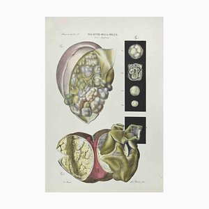 Ottavio Muzzi, Diseases of the Spleen, Lithograph, 1843-ZCI-2029992