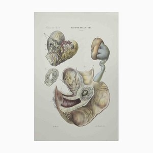 Ottavio Muzzi, Diseases of the Uterus, Lithograph, 1843-ZCI-2029995