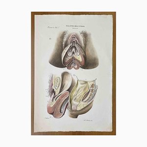 Ottavio Muzzi, Diseases of the Uterus, Lithograph, 1843-ZCI-2030164