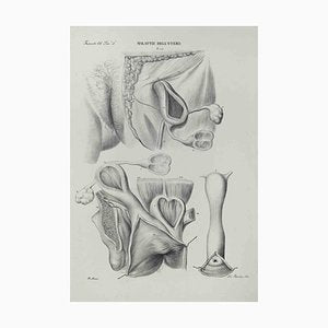 Ottavio Muzzi, Diseases of the Uterus, Lithograph, 1843-ZCI-2029980