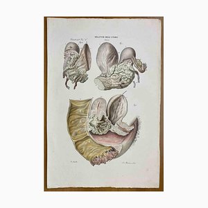 Ottavio Muzzi, Diseases of Uterus, Lithograph, 1843-ZCI-2030139