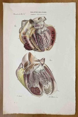 Ottavio Muzzi, Heart Diseases, Lithograph, 1843-ZCI-2030147