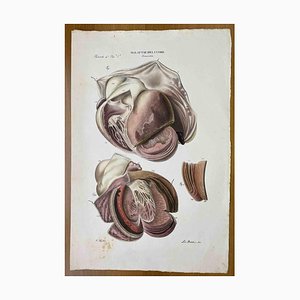 Ottavio Muzzi, Heart Diseases, Lithograph, 1843-ZCI-2030168