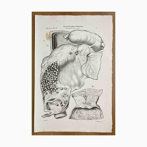 Ottavio Muzzi, Intestinal Diseases, Lithograph, 1843-ZCI-2030166