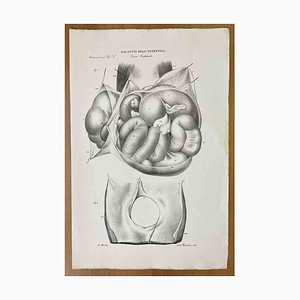 Ottavio Muzzi, Intestinal Diseases, Lithograph, 1843-ZCI-2030175