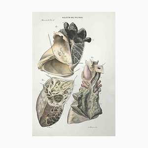 Ottavio Muzzi, Lung Diseases, Lithograph, 1843-ZCI-2029985