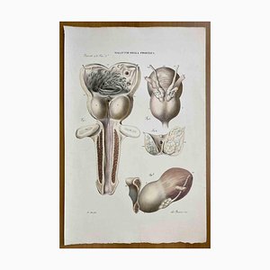 Ottavio Muzzi, Prostate Diseases, Lithograph, 1843-ZCI-2030152