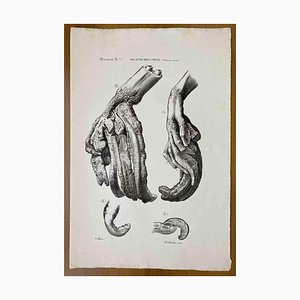 Ottavio Muzzi, Skin Diseases, Lithograph, 1843-ZCI-2030170