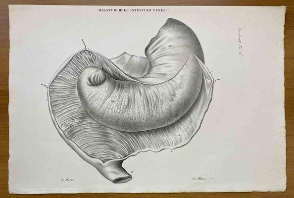 Ottavio Muzzi, Small Intestine Disease, Lithograph, 1843-ZCI-2030154