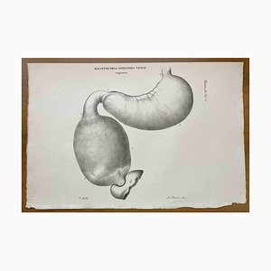 Ottavio Muzzi, Small Intestine Disease, Lithograph, 1843-ZCI-2030146