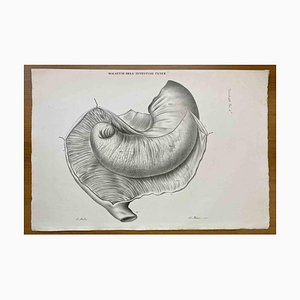 Ottavio Muzzi, Small Intestine Disease, Lithograph, 1843-ZCI-2030154