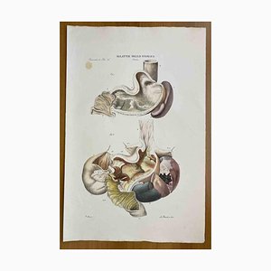 Ottavio Muzzi, Stomach Diseases, Lithograph, 1843-ZCI-2030165