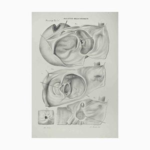 Ottavio Muzzi, Stomach Diseases, Lithograph, 1843-ZCI-2030002