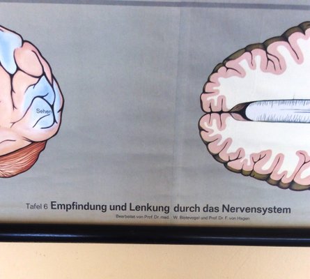 Pull-Down Anatomical Wall Chart by Hagemann, Düsseldorf, 1970s-MCB-1731837