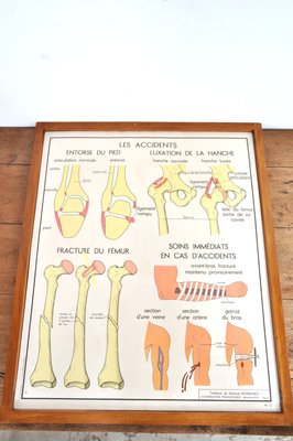 Vintage Double Sided School Posters in Frame of the Human Body, 1950s-AOX-2024623