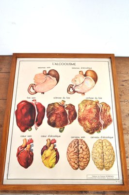 Vintage Double Sided School Posters in Frame of the Human Body, 1950s-AOX-2024623